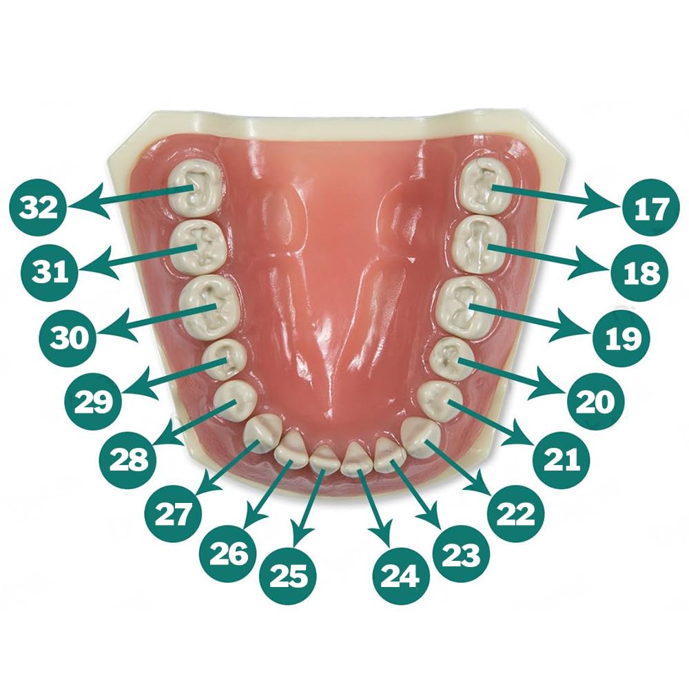 Dental Model 860-Prep with Crowns and Cavities