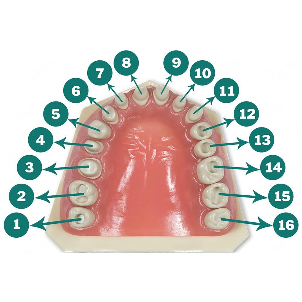 Dental Model 860-Prep with Crowns and Cavities
