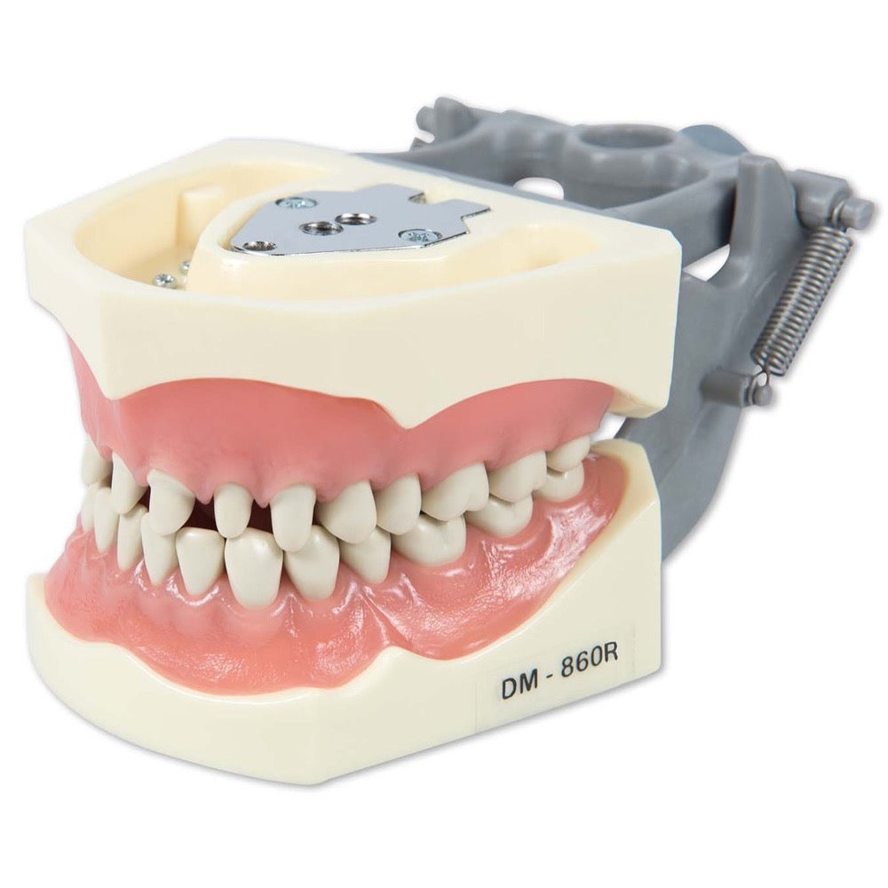 Dental Model 860-Prep with Crowns and Cavities