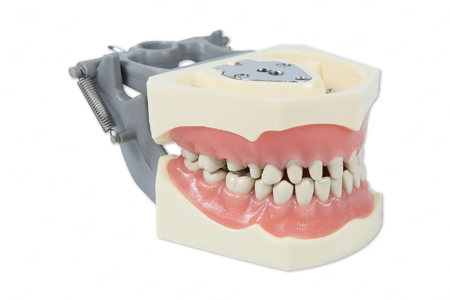 Dental Model 860-Prep with Crowns and Cavities