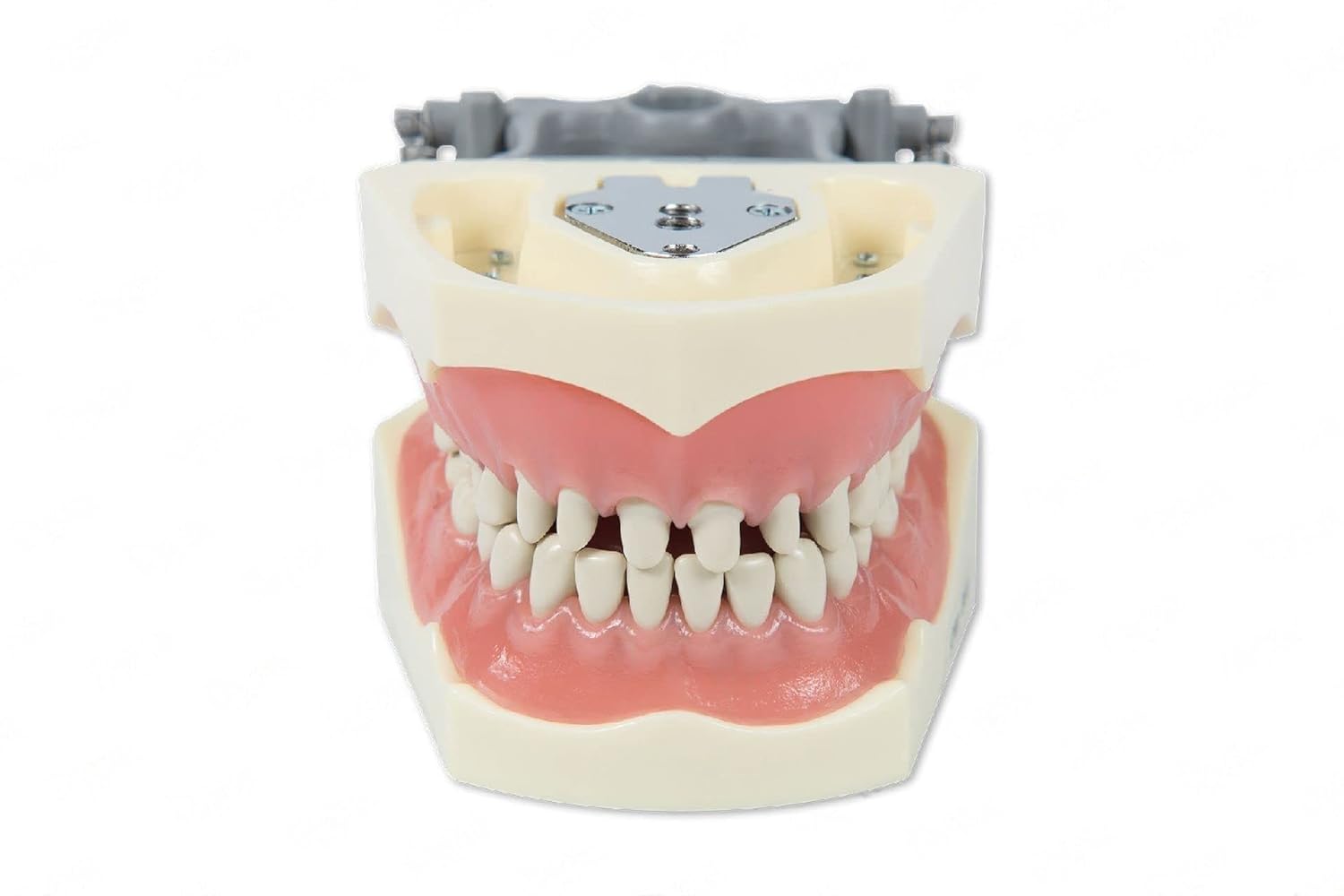 Dental Model 860-Prep with Crowns and Cavities