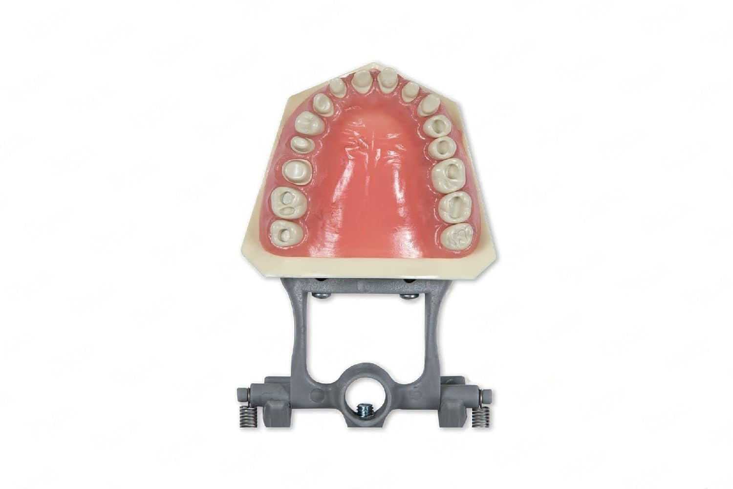 Dental Model 860-Prep with Crowns and Cavities
